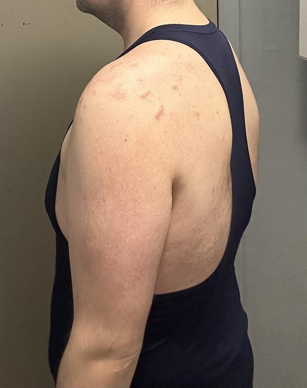 Photo submitted with review of product