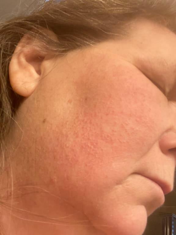 Review Thumbnail Image 0 264629276