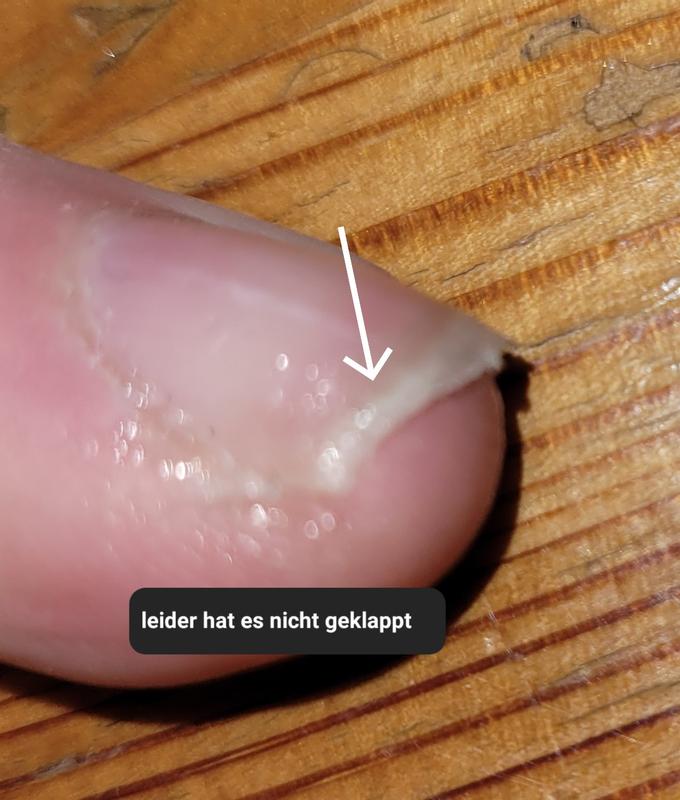 Auch ein bzw abgerissen