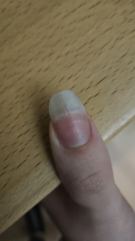 Nagel unbehandelt