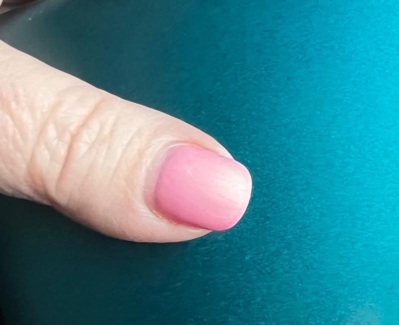 Bewertung zu Foto 1.