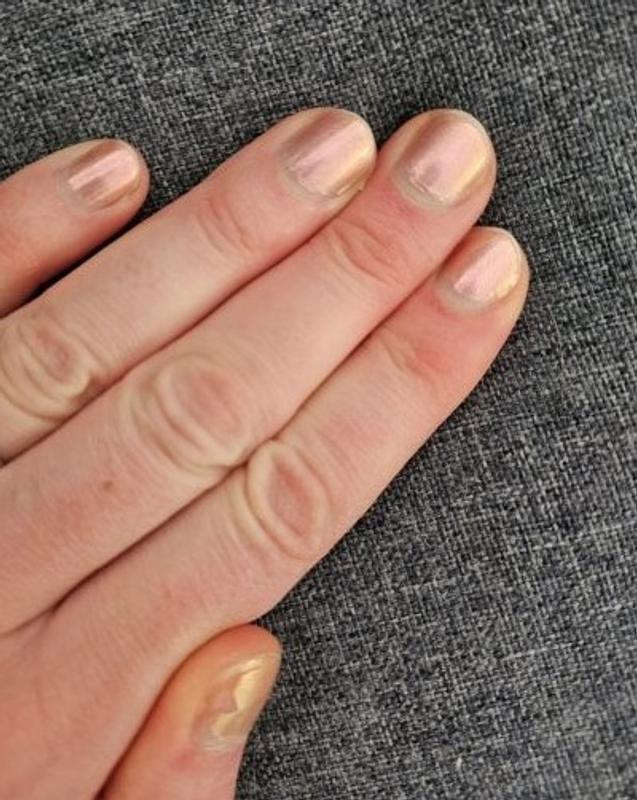 Tag 14 linke Hand