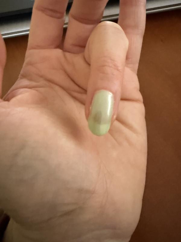 Bewertung zu Foto 1.