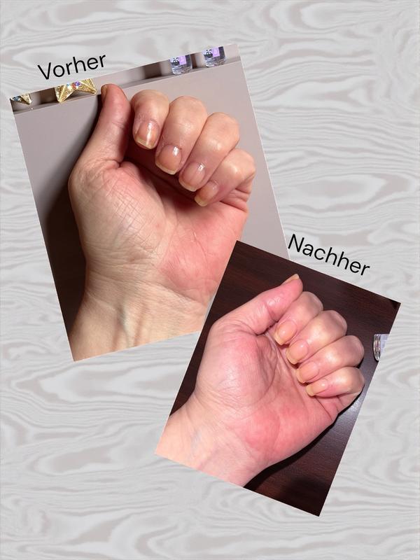 Nicht mehr so brüchig