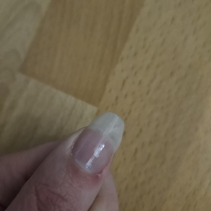 3. Tag Schaden immer noch zu sehen