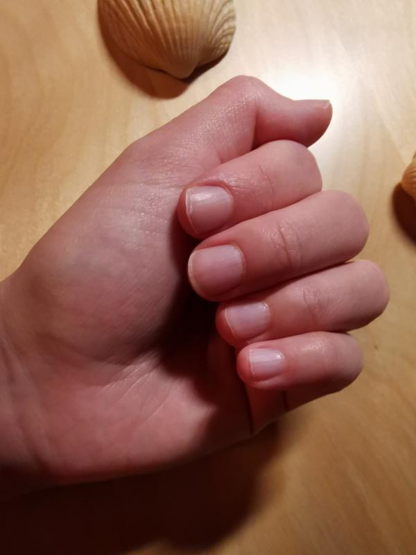 Kaputte Nägel