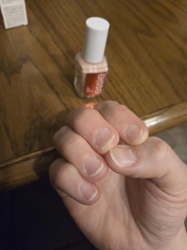 Vor essie - to the rescue