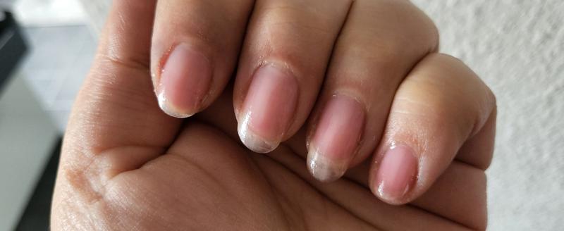 Brüchige Nägel mit  essie