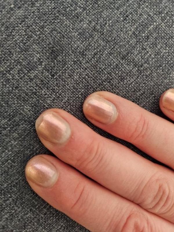 Tag 14 rechte Hand