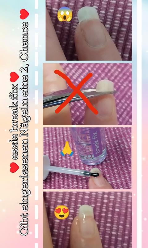 SOS Nagelrettung