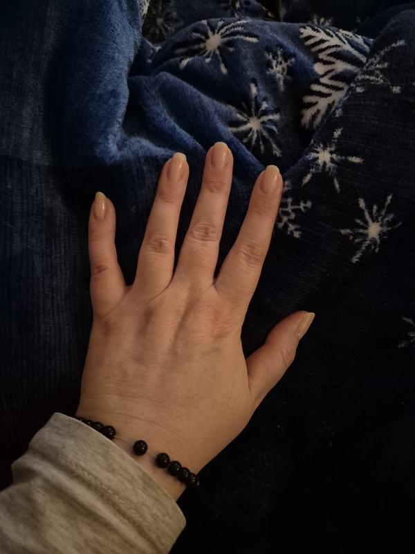 Meine Hand nach 1 Woche