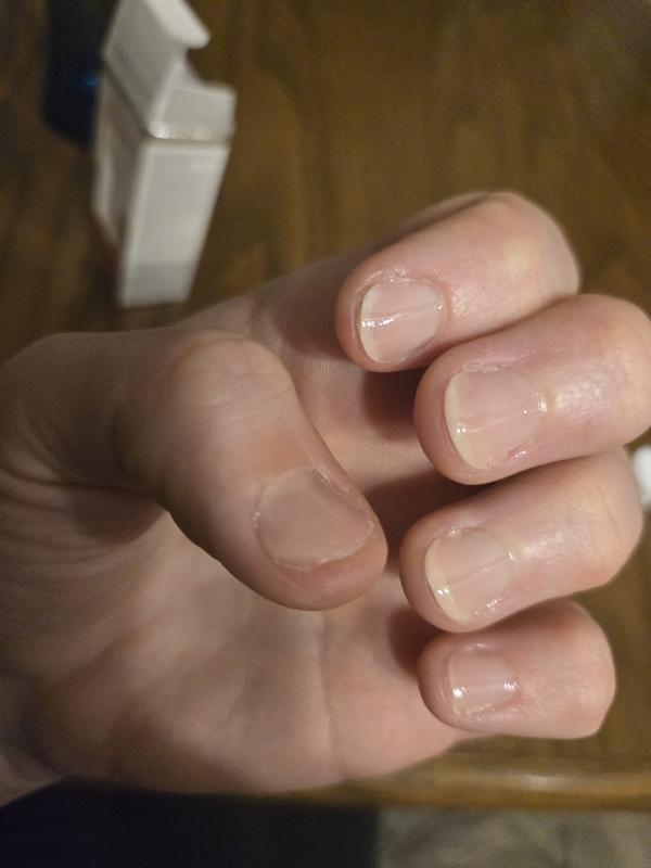 Mit dem essie - to the rescue