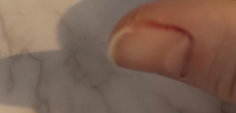 Before applying as you can see the crack at the top of my thumb nail.