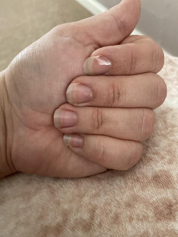 On nails
