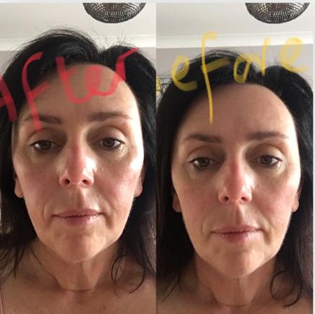 eucerin anti redness day cream