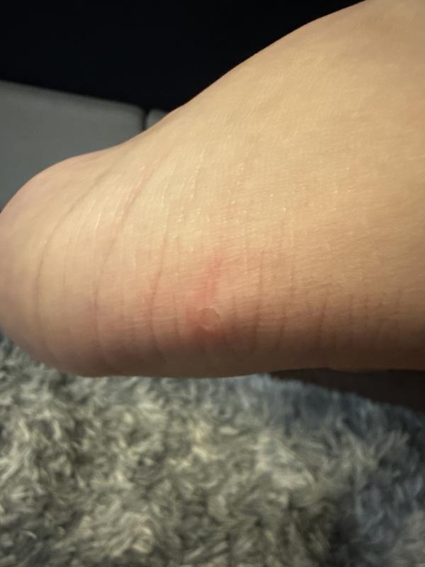 Photo submitted with review of product