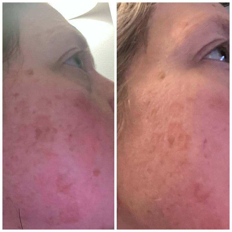 Review Thumbnail Image 0 337645985