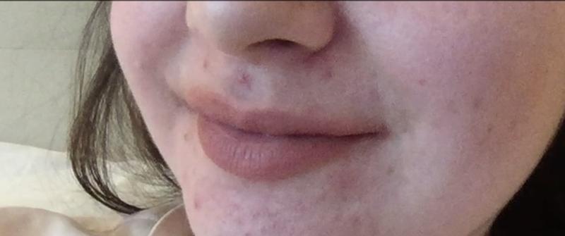 Review Thumbnail Image 0 377730123