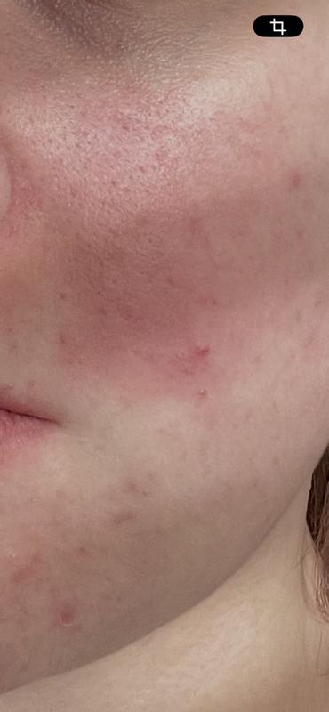 Review Thumbnail Image 1 381511898