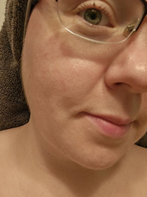 Review Thumbnail Image 0 381383819