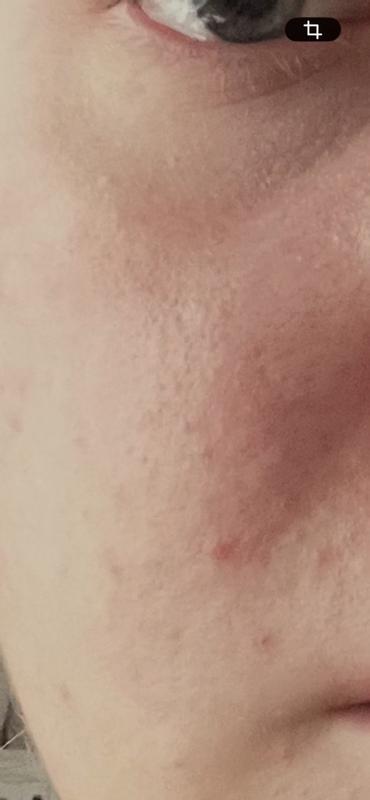 Review Thumbnail Image 2 381511898