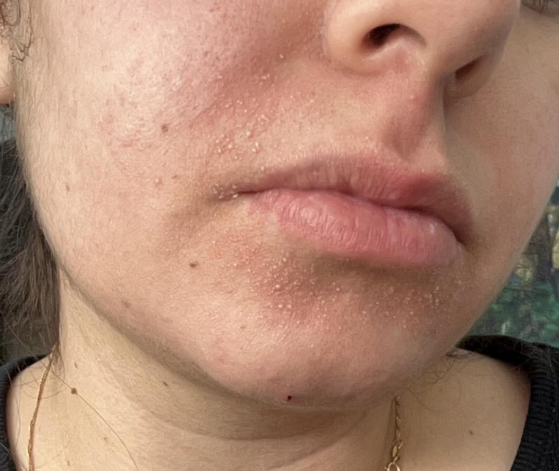 Review Thumbnail Image 0 338237507