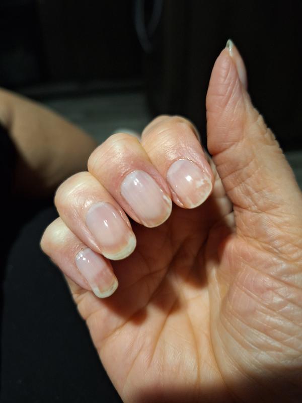 Vitality Extracts Essential Oils - How to use Nail Envy? Massage a few  drops of Nail Envy into your cuticles and on your fingernails. Doing is on  a daily basis can help