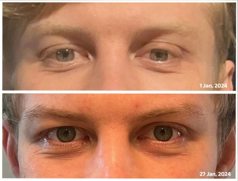 Review Thumbnail Image 0 270378071