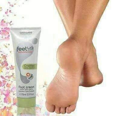 oriflame feet up for stretch marks