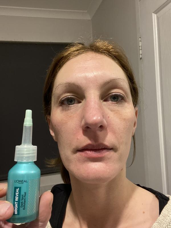 After using product for 6 weeks