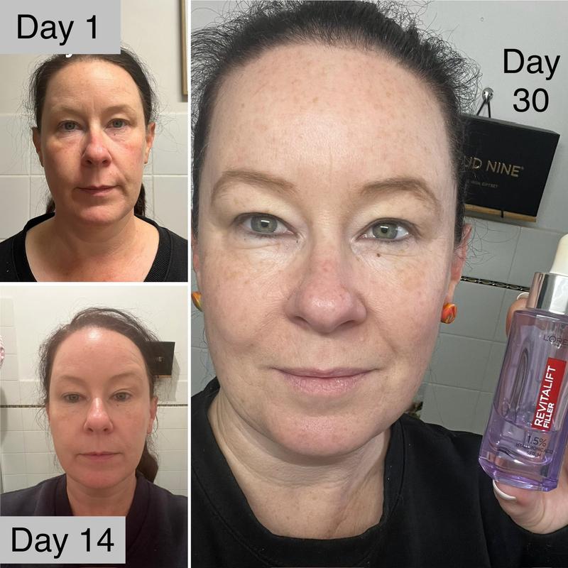 Day 1 to day 30 comparison