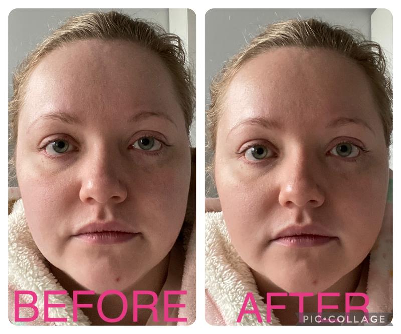 Before/After