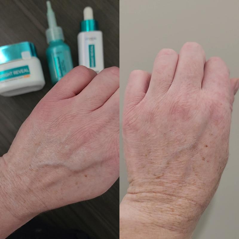 Younger looking skin!