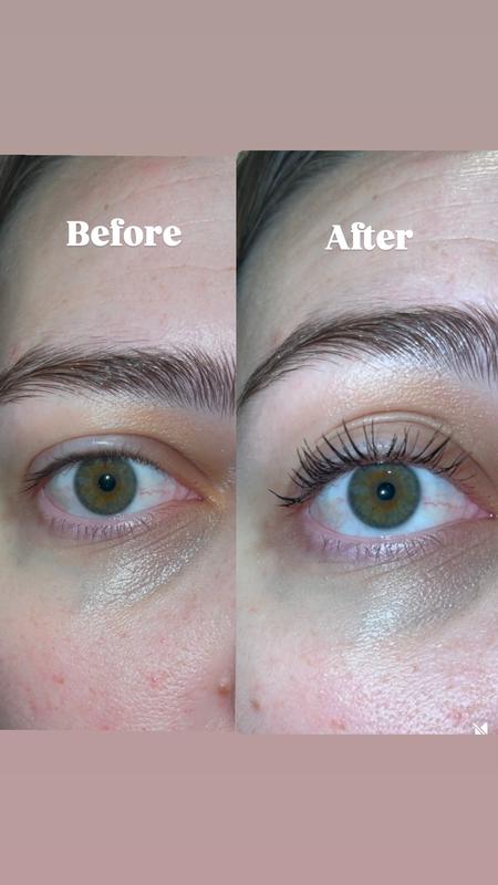 Before and After