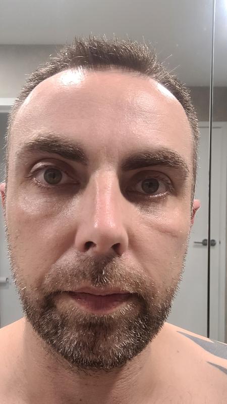 After photo and happy with result.