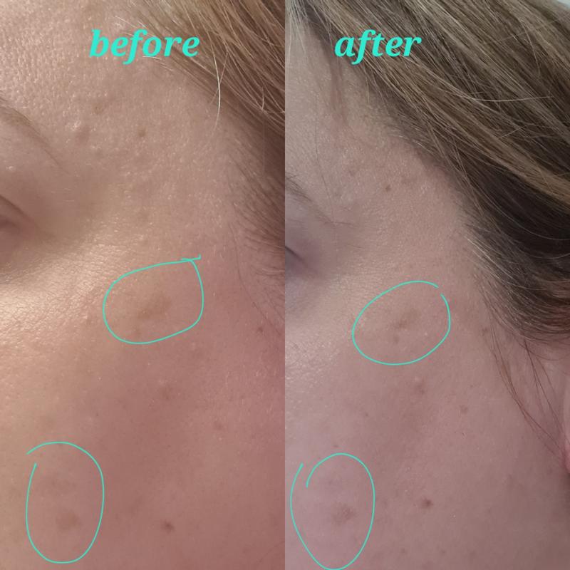Before and after
