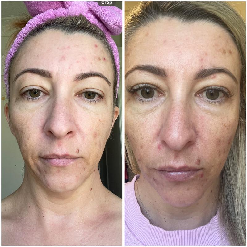 Before (L) and after (R)