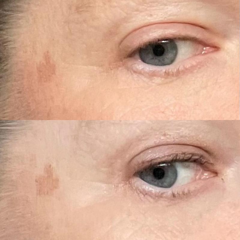 Paler after 8 weeks
