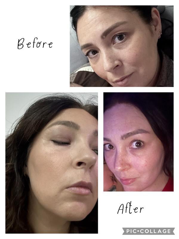 Before and Afters