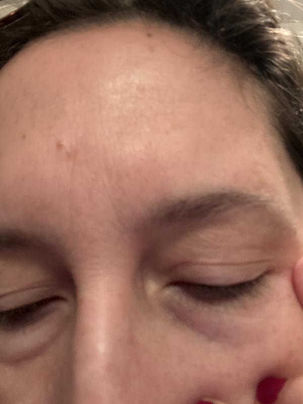My eyes look worse now