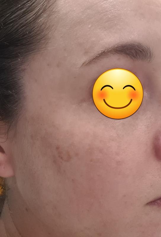Brighter skin tone