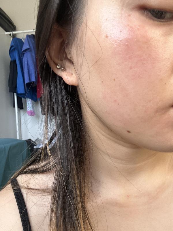 My skins turned out to be like this