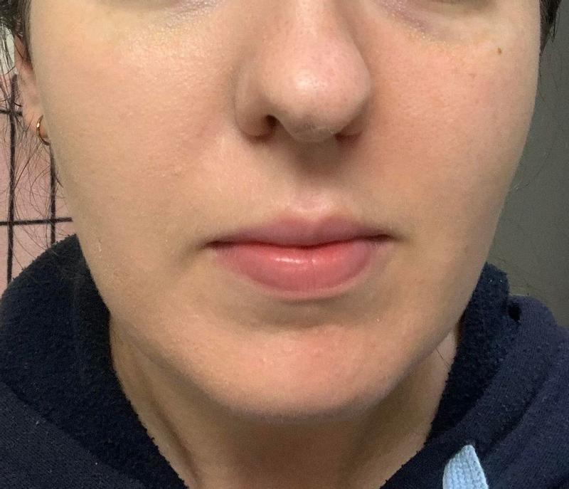 My face half with the serum and half without