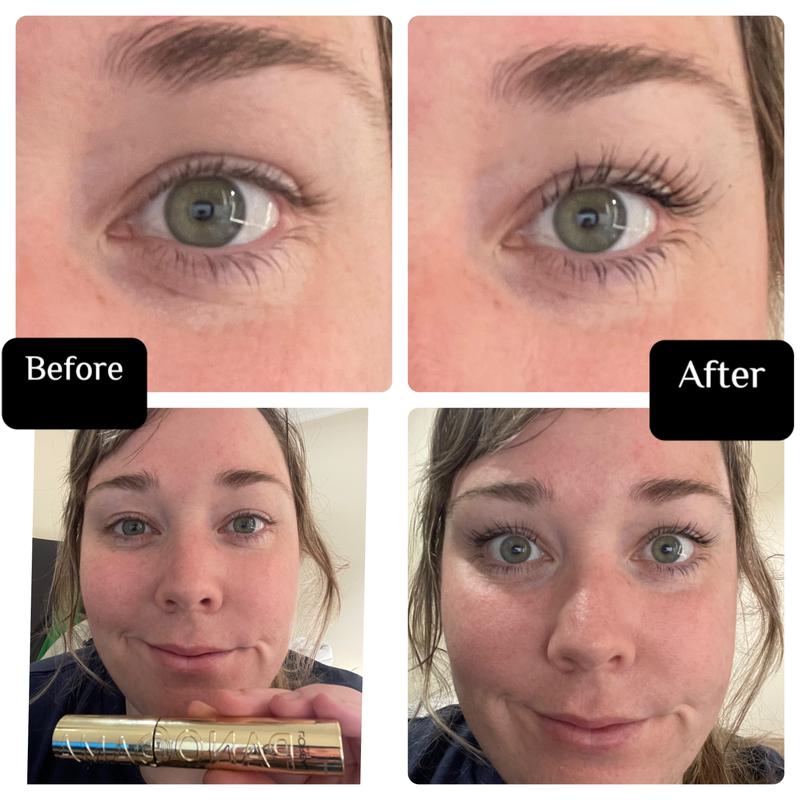 Before and after