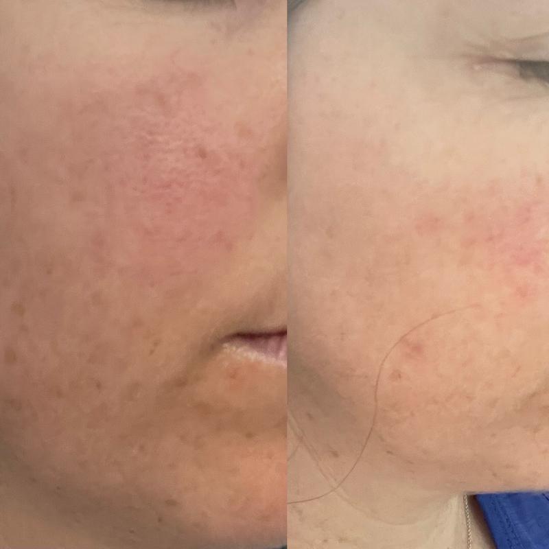 L2R - before and after