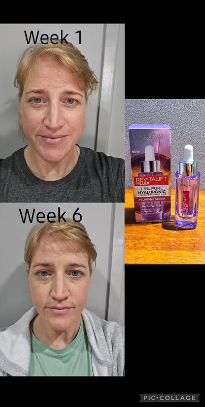 Week 1 vs Week 6 of using the Revitalify Serum