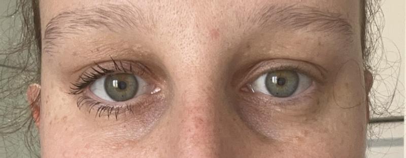 Eye comparison.