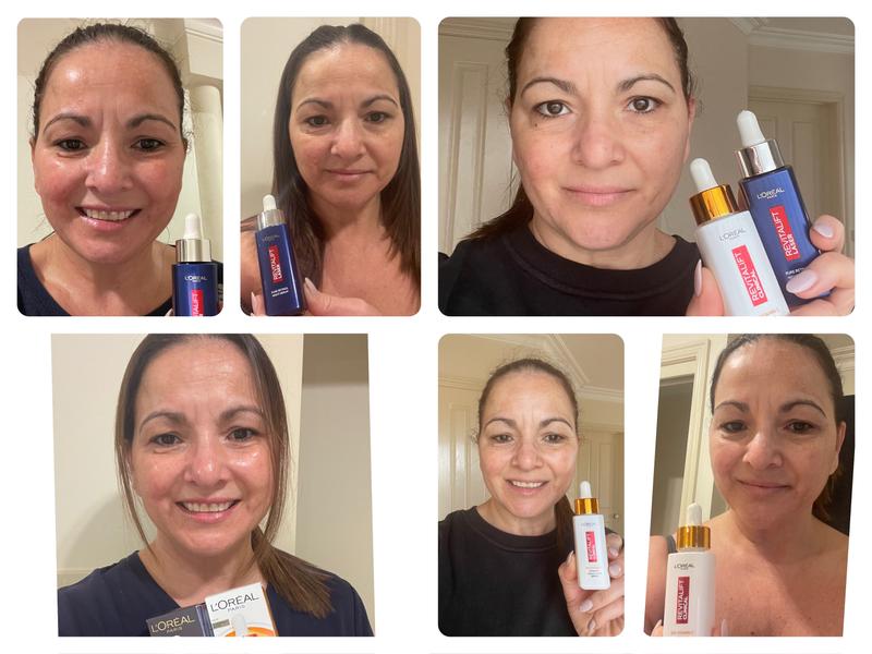 Before and after of the serums