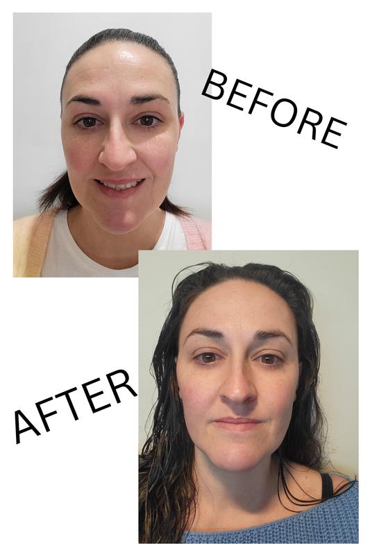 Before and after photo