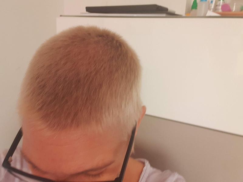 vorher vor Anwendung